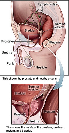 Natural Prostate Remedy